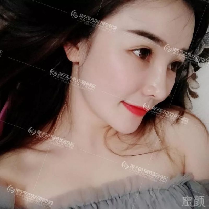 https://img.miyanlife.com/mnt/timg/180712/120T11518-3.jpg