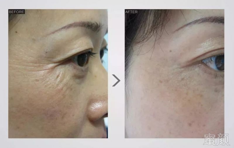 https://img.miyanlife.com/mnt/timg/180712/12101TF7-7.jpg