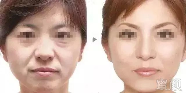 https://img.miyanlife.com/mnt/timg/180712/12101UI2-6.jpg