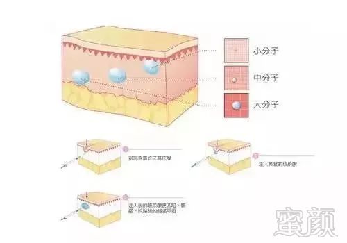 案例图片