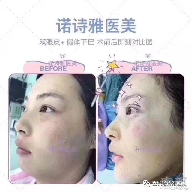 https://img.miyanlife.com/mnt/timg/180712/121G61T8-1.jpg