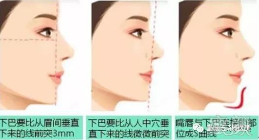https://img.miyanlife.com/mnt/timg/180712/121G640M-2.jpg
