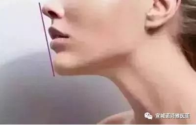 https://img.miyanlife.com/mnt/timg/180712/121GIB2-3.jpg