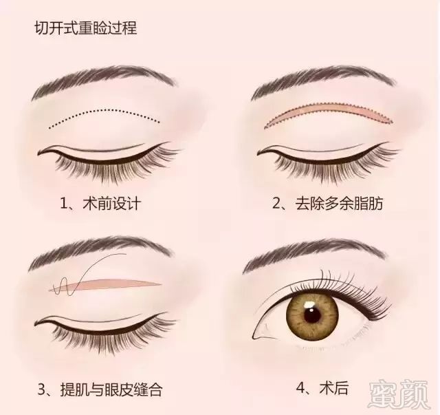 https://img.miyanlife.com/mnt/timg/180712/1226152132-4.jpg