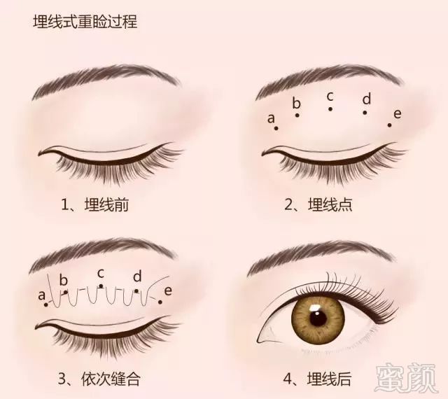 https://img.miyanlife.com/mnt/timg/180712/12261560W-2.jpg