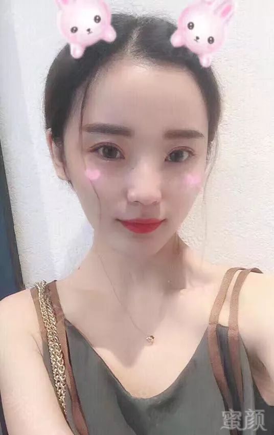 https://img.miyanlife.com/mnt/timg/180712/12261AM1-6.jpg