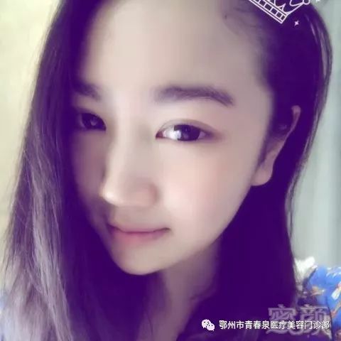 https://img.miyanlife.com/mnt/timg/180712/12351963S-3.jpg