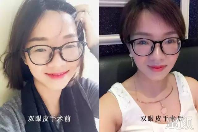 https://img.miyanlife.com/mnt/timg/180712/12351RR2-0.jpg