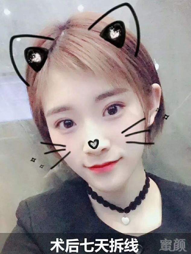 https://img.miyanlife.com/mnt/timg/180712/123GK559-8.jpg
