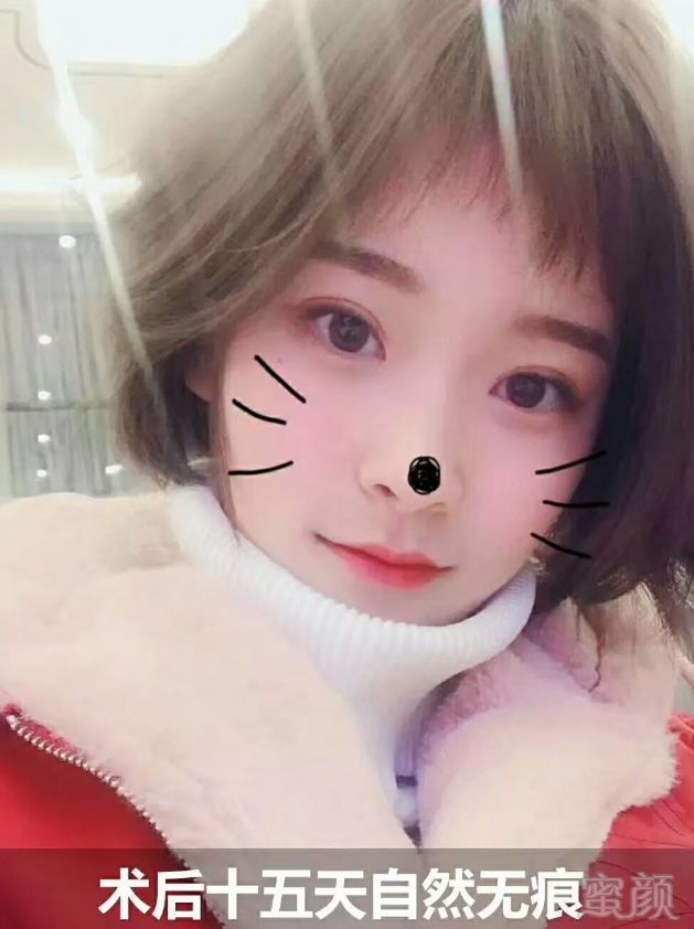 https://img.miyanlife.com/mnt/timg/180712/123H01P0-9.jpg