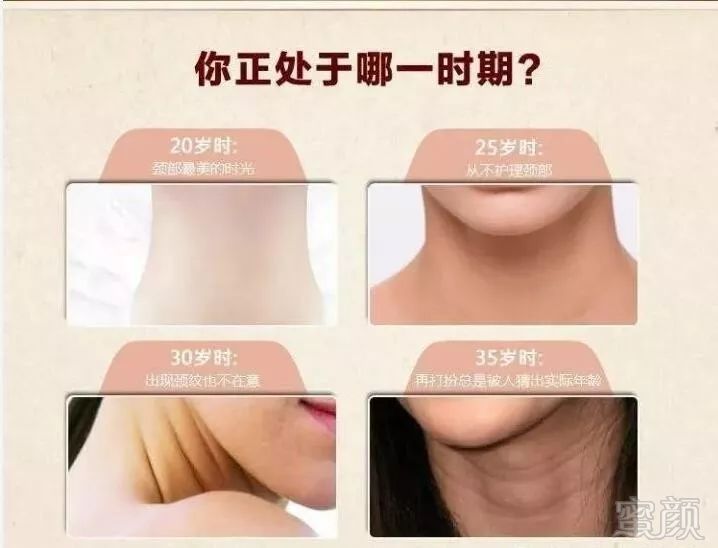 https://img.miyanlife.com/mnt/timg/180713/105KG1S-2.jpg