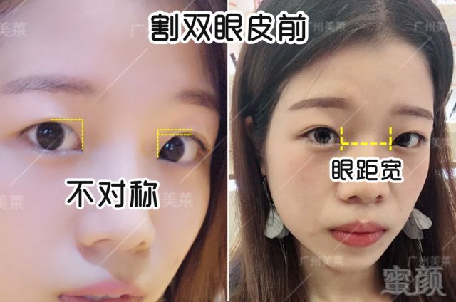 https://img.miyanlife.com/mnt/timg/180713/1140542S0-3.jpg