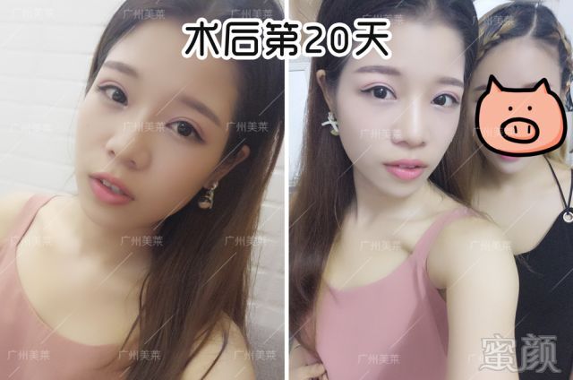 https://img.miyanlife.com/mnt/timg/180713/1140552111-8.jpg