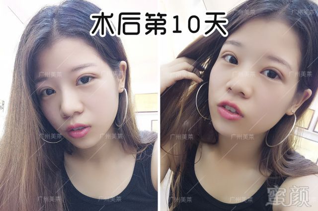https://img.miyanlife.com/mnt/timg/180713/114055G35-7.jpg