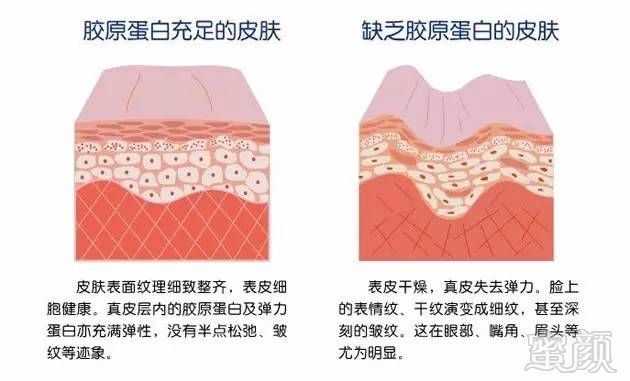 https://img.miyanlife.com/mnt/timg/180713/11414033Y-2.jpg