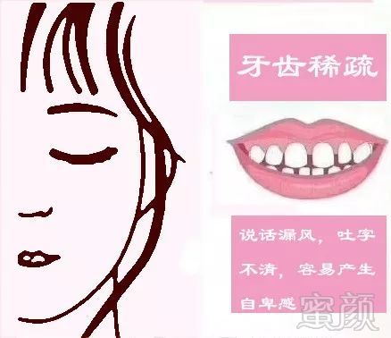 https://img.miyanlife.com/mnt/timg/180713/114309AX-7.jpg