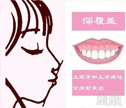 https://img.miyanlife.com/mnt/timg/180713/11430K320-4.jpg