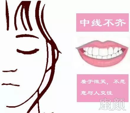 https://img.miyanlife.com/mnt/timg/180713/11430TL6-6.jpg