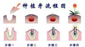 https://img.miyanlife.com/mnt/timg/180713/1205025001-1.jpg