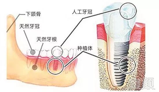 https://img.miyanlife.com/mnt/timg/180713/120503N58-7.jpg