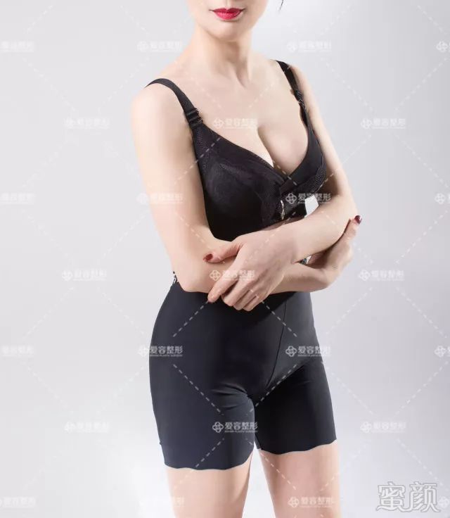 https://img.miyanlife.com/mnt/timg/180713/12144145Y-19.jpg
