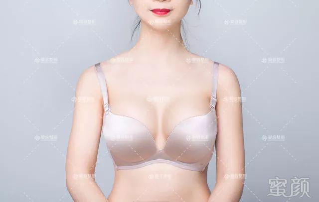 https://img.miyanlife.com/mnt/timg/180713/121441Ib-18.jpg