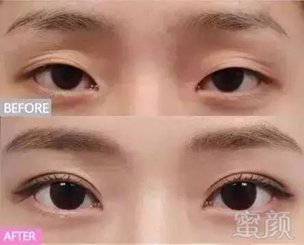 https://img.miyanlife.com/mnt/timg/180713/1224112V6-12.jpg
