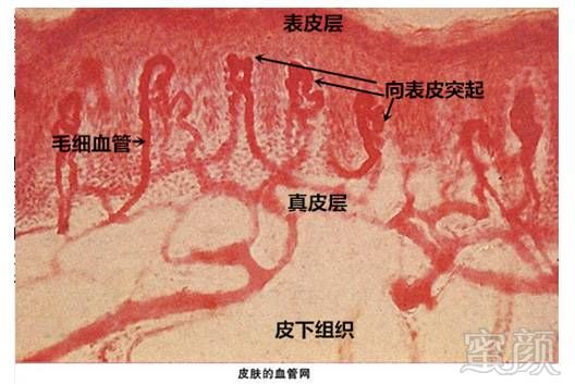 案例图片