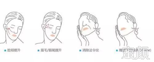 https://img.miyanlife.com/mnt/timg/180714/1221004H7-6.jpg