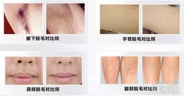 https://img.miyanlife.com/mnt/timg/180714/122415A94-4.jpg