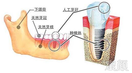 案例图片