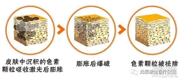 https://img.miyanlife.com/mnt/timg/180714/1230525917-2.jpg