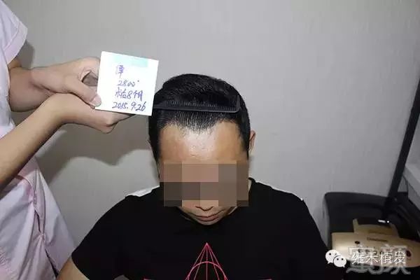 https://img.miyanlife.com/mnt/timg/180714/131455OA-11.jpg