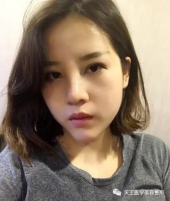 https://img.miyanlife.com/mnt/timg/180715/104504G51-3.jpg