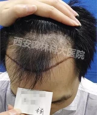 https://img.miyanlife.com/mnt/timg/180715/1104061A7-1.jpg
