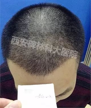 https://img.miyanlife.com/mnt/timg/180715/11040C0b-3.jpg