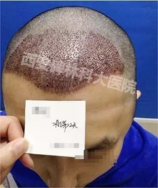 https://img.miyanlife.com/mnt/timg/180715/11040CF1-2.jpg