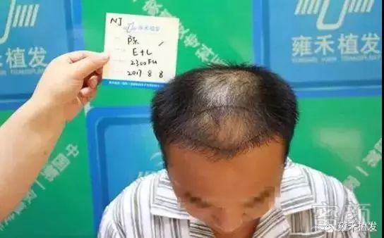 https://img.miyanlife.com/mnt/timg/180715/110431E11-0.jpg