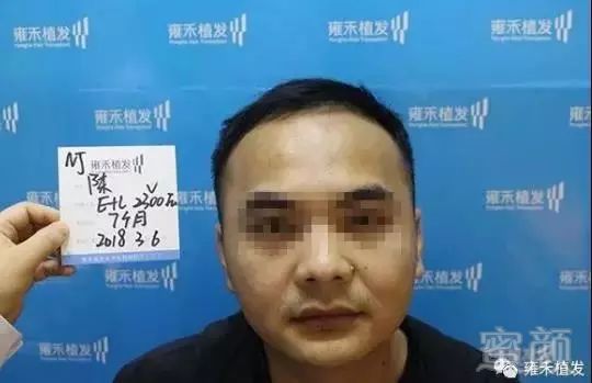 https://img.miyanlife.com/mnt/timg/180715/1104336336-6.jpg