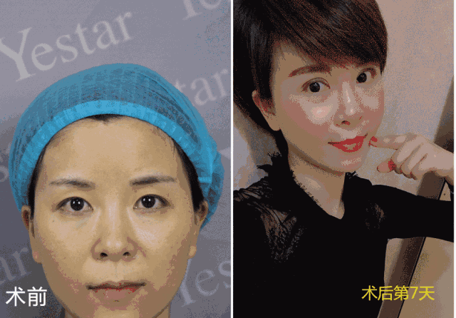 https://img.miyanlife.com/mnt/timg/180715/12552543O-7.jpg