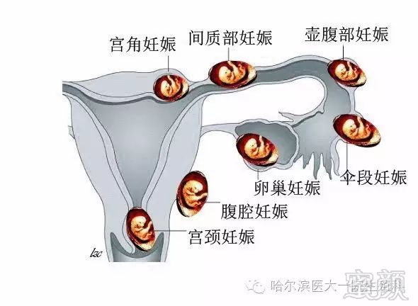 https://img.miyanlife.com/mnt/timg/180717/111T03F9-0.jpg