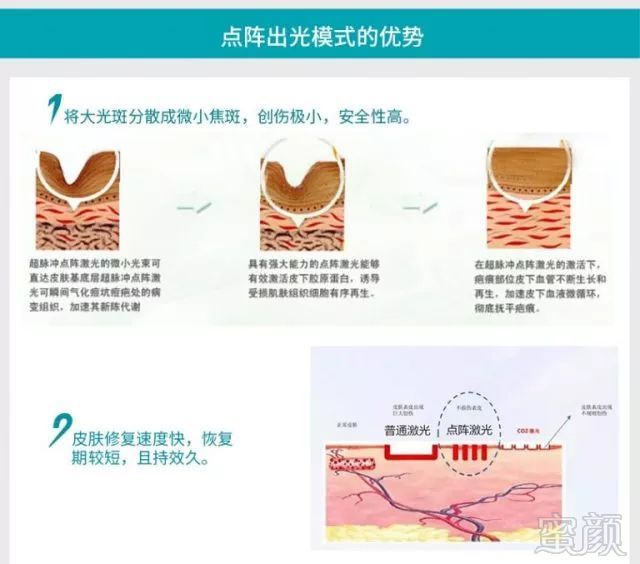 https://img.miyanlife.com/mnt/timg/180717/112GKH5-4.jpg