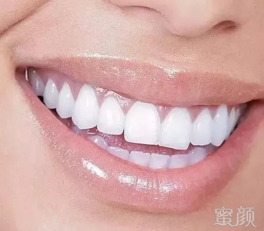 https://img.miyanlife.com/mnt/timg/180717/1145552Y2-10.jpg