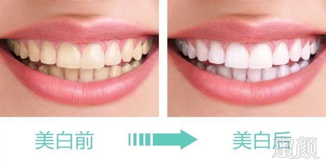 https://img.miyanlife.com/mnt/timg/180717/1145553612-13.jpg