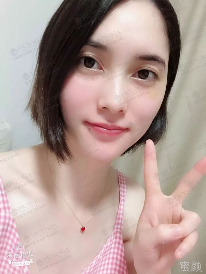 https://img.miyanlife.com/mnt/timg/180717/1146191554-9.jpg