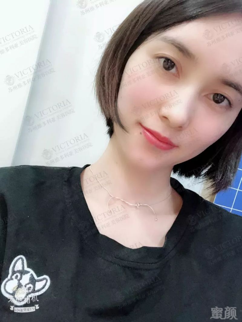 https://img.miyanlife.com/mnt/timg/180717/11461IN7-8.jpg