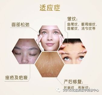 https://img.miyanlife.com/mnt/timg/180717/1151154340-0.jpg