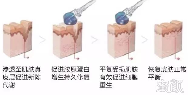 https://img.miyanlife.com/mnt/timg/180717/1151162249-6.jpg