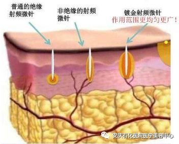 https://img.miyanlife.com/mnt/timg/180717/1151163395-2.jpg