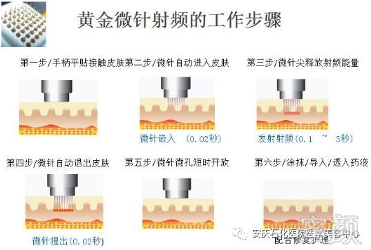 https://img.miyanlife.com/mnt/timg/180717/11511Cc1-1.jpg